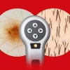 FotoFinder Leviacam