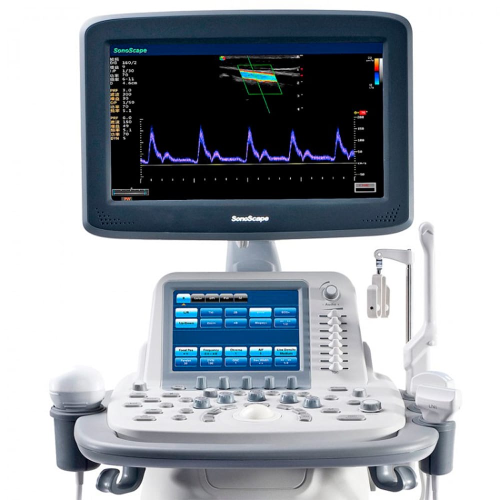 Узи экспертного класса. SONOSCAPE s20exp. УЗИ SONOSCAPE s20exp. УЗИ аппарат SONOSCAPE s20exp. УЗИ аппарат Соноскейп s20.